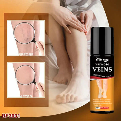 BEE VENOM VARICOSE VEINS RELIEF SPRAY (BUY 1 GET 1 FREE)(PACK OF 2)